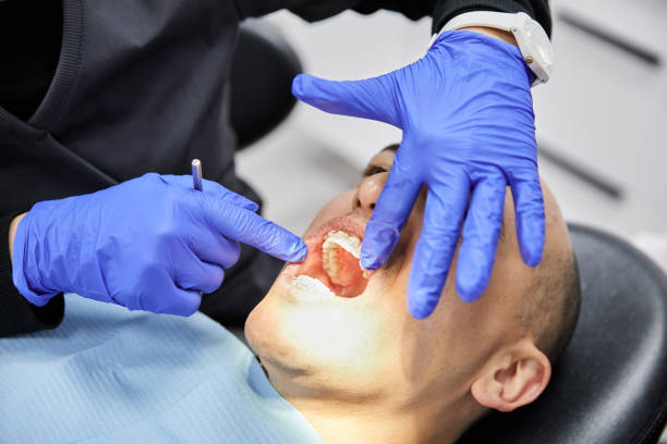 Best Emergency Tooth Extraction in Marlin, TX