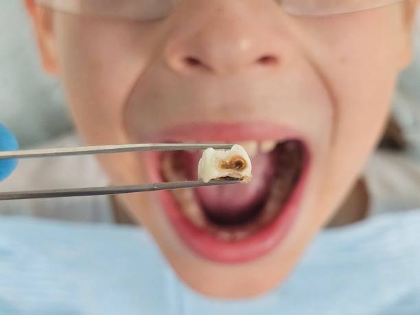 Best Same-Day Emergency Dentist in Marlin, TX